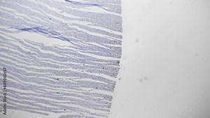 Myocardium in section magnified under light micrograph 40x on bright field background. Isolated macro view of human heart muscle. Histology investigation in laboratory. Study people tissue structure