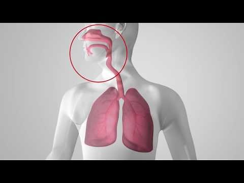 Vapotherm High Velocity Therapy Animation | Refined High Flow Nasal Cannula for Respiratory Distress