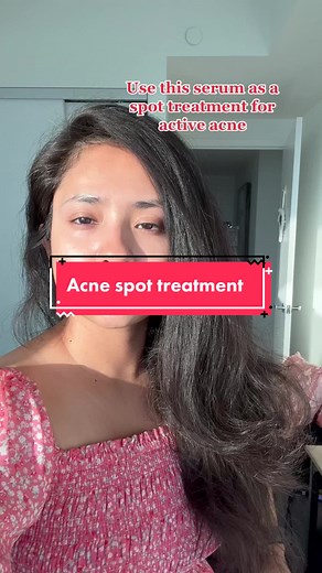 Salicylic acid is not like benzoyl peroxide but due to its anti inflammatory properties it works so well on acne! #acnetreatment #acneskin #salicylicacid #serums #esthetician