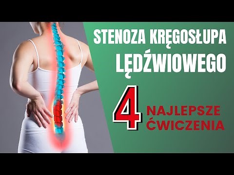Lumbar spinal stenosis – exercises