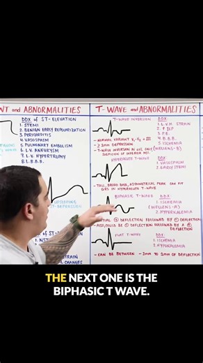 Ninja Nerd on Instagram: "Not all T waves are created equal.⚡ Biphasic? Flat? Peaked? Each pattern tells a completely different clinical story: ischemia, electrolyte imbalance, evolving pathology. Zach walks you through exactly how to recognize them and, more importantly, how to think about them. ✨ If this clip helped you, go watch the full-length lecture on the Ninja Nerd YouTube channel: MASTER ECG/EKG INTERPRETATION. That’s where real understanding happens. #NinjaNerd #EKGInterpretation #Futu