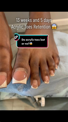 Do Acrylic Toes Last? Nail Retention Results Revealed!