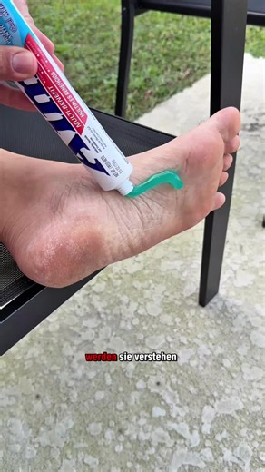 Zahnpasta-Fußtrick für perfekte Füße