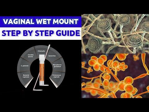 Vaginal Wet Mount Preparation| |MEDICAL LABORATORY SCIENCE