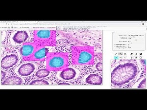 Quick Annotator: A Tool for Rapidly Annotating Digital Pathology Images