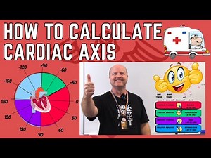 How to calculate Cardiac Axis