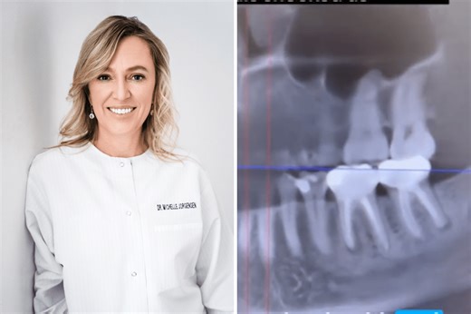 Dentist Checks Cancer Patient’s Mouth, Shock Over What’s Seen in Root Canal
