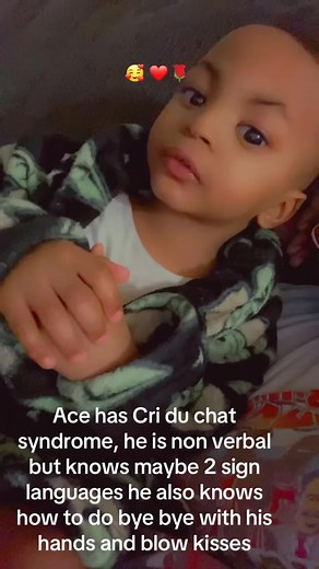 Ace is non verbal , he know 2 sign languages , ( all done and more ) , we is taking it one step at a time for him to learn different sign languages we only do 2 with him at a time so he can remember and learn , but he can let me know when he wants something he will go to it and let me know thats what he wants and im proud and happy that he is doing BETTER AND BETTER 🥹🥰❤️😩 PS. he also had to learn how to use his fingers and hands now that he has that down packed its on too the next ❤️#fypppppp