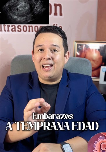 🔍 ¿Sabías qué es una ecografía transvaginal? Es un estudio que permite ver con claridad el útero, ovarios y cuello uterino. Ideal para confirmar embarazo temprano, controlar quistes o irregularidades. 📆 ¿Cuándo hacerla? ✔️ Desde las 5 semanas de embarazo ✔️ Si tienes dolor pélvico o sangrados irregulares 👩‍⚕️ En Ecolife Deluxe, realizamos este estudio con equipos de alta tecnología y atención especializada. 📍Santa Cruz – Agenda tu cita al 📲 78000067 #EcolifeDeluxe #EcografíaTransvaginal #Sa