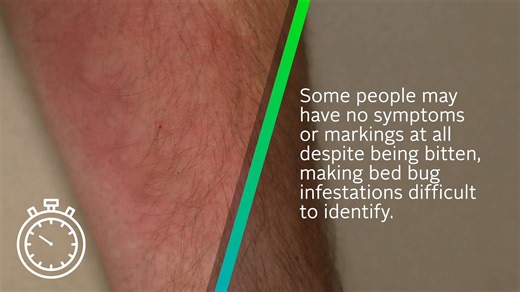 14 reactions · 20 shares | Bed bugs are no joke as these pests hide for 5-10 days after feeding to mate and reproduce. Here’s how to know if you’ve been bitten. | PestWorld | Facebook