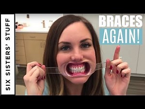 ADULT BRACES vs. INVISALIGN - My Orthodontist Consultation