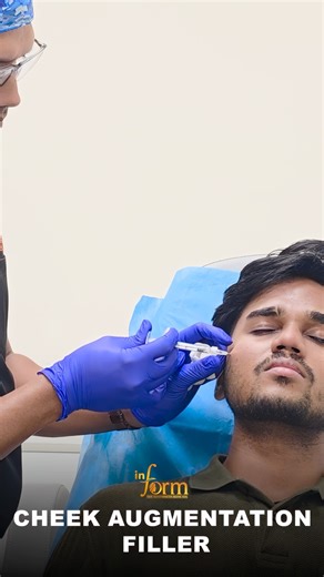 The Secret to Youthful Cheeks | Cheek Augmentation Filler #skincare #fillers #ytshorts #informclinic