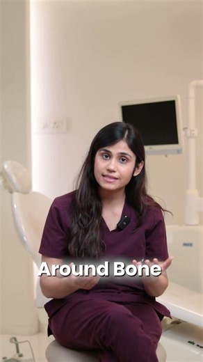 Agar tooth me decay hai, to RCT karaye ya implant? #rct #implantdentistry