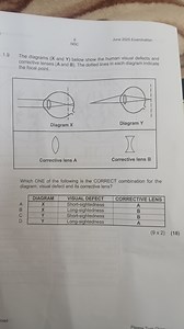 The diagrams (X and Y) below show the human visual defects and ... | Filo