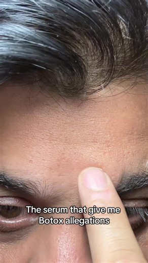 Anti-Aging Glowing Skin: The Benefits of Botox Serum