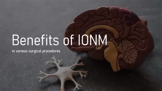 How IONM improves surgical outcomes and patient safety | ASNM - American Society Of Neurophysiological Monitoring posted on the topic | LinkedIn