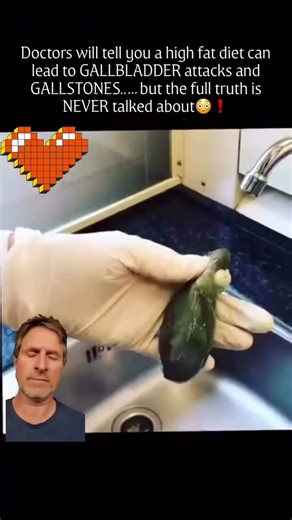 Start a cleanse today! We can help you prepare and take on a liver and gallbladder cleanse. It is important to take the proper steps leading up to it to get the best results and not do more harm than good! Follow for how to best prepare for a cleanse. | Healing of The Body and Mind