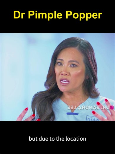 Cystic Acne Removal with Dr. Pimple Popper