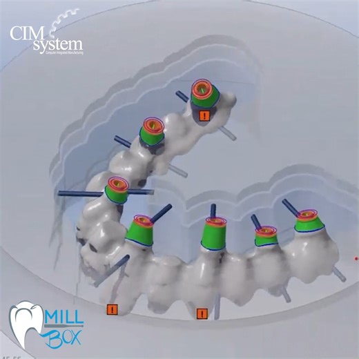 🚀 New MillBox Feature: Object Analysis before Calculation! MillBox users can now check their toolset selection before running a full kinematic simulation by using our new Object Analysis button on the right-side panel of the calculation interface. This added option can help reduce potential milling errors and save users time. Find out which dental objects this new feature is available for at: https://t.ly/MillBoxNews 🦷✨ | CIMsystem Dental