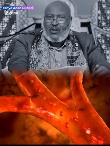 Xanuunka sonkorta (Macaanka) Sharaxaad #drxoog | Yahye Adan Dubad