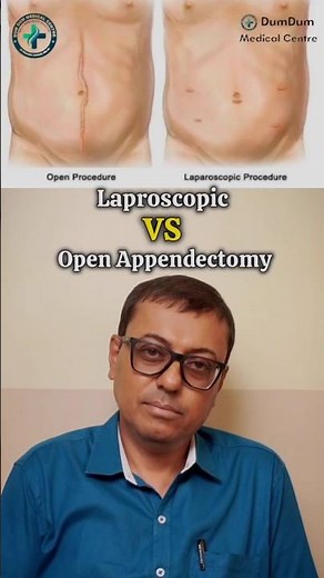 laparoscopy or open surgery? Here’s what you must know