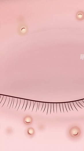 The safe way to remove milia around eyes #reels | Meng's Stop Motion