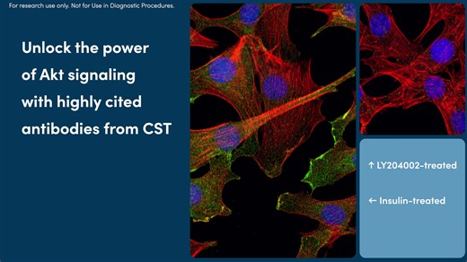 Unlock the 💪 power of Akt signaling with our highly cited antibodies! With 🌟 over 48,000 citations 🌟 our Akt antibodies are trusted by researchers worldwide to study cellular functions including metabolism, growth, proliferation, survival, transcription, and protein synthesis. ✅ Trust the literature, trust the results. https://hubs.ly/Q03Lk4fr0 | Cell Signaling Technology, Inc.
