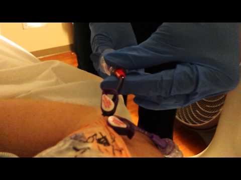 Blood draw from my PICC line