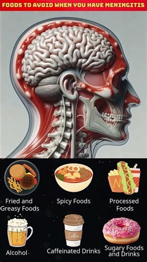 Avoid These Foods During Meningitis Recovery