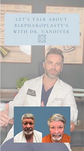 15 reactions | Let’s talk about all things upper eyelid and lower eyelid surgery, also known as a Blepharoplasty, with Dr. Vandiver. Here you can learn all about the procedure, the downtime and the recovery, along with seeing real results of a before and after of one of his patients! | Hedden, Gunn and Halka Plastic Surgery | Facebook