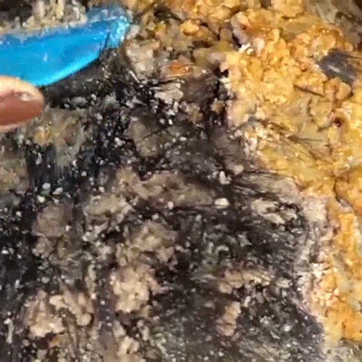 Wa Ha Big WORM HOLE Flake On Scalp Treatment !! Big Psoriasis Scalp Treatment #407 #ticks #removetick #Dandruff #dandrufftreatment #dandruffremoval | Help remove ticks