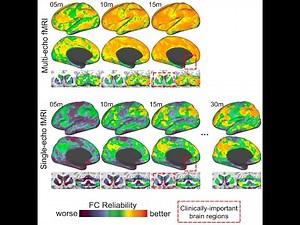 Multi-Echo Sequences and Resting-State fMRI