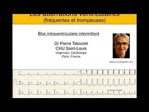 4h. Aberration ventriculaire (bloc de branche) ou ESV ? ECG Dr Taboulet