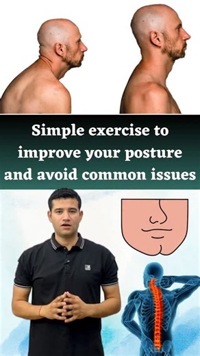 21K views · 50K reactions | Simple exercises to improve your posture and avoid common issues ✅ #posture #posturecorrection #hunchback #neck #roundedshoulders #neckpain #gym #yoga #forwardheadposture #spinehealth #dailypractice #yoggurudeepaksharma #yogareels #viral #yogapractice #reels #fitness | Yog Guru Deepak Sharma | Facebook