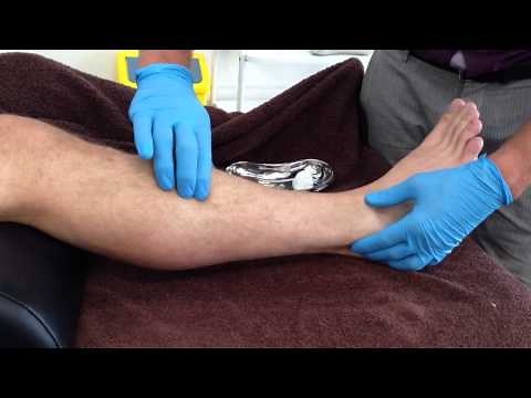 Dry Needling: Extensor Digitorum Longus
