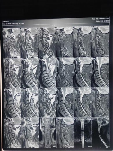 learn spine #ultrasound #ct#mri #life#neurosurgery