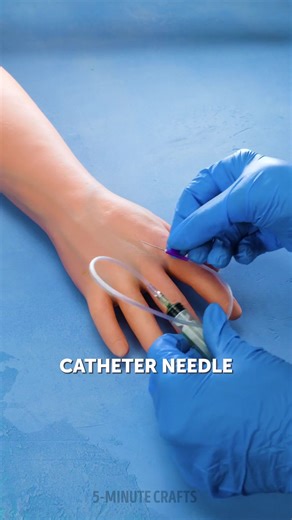 Different medical techniques that you probably haven't seen before! | 5-Minute Crafts