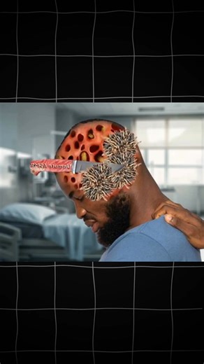 Treatment head worms removal | Eleven sergio