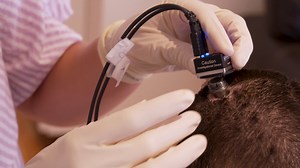 964 reactions · 200 shares | Meet Ann. After 18 years of paralysis, she is rediscovering her voice thanks to an AI brain implant from the UCSF Department of Neurological Surgery, the Chang Lab, and Berkeley Engineering. With tiny brain electrodes decoding her speech signals, Ann can speak sentences using synthesized speech and a digital avatar. https://tiny.ucsf.edu/ghyt39 | UCSF | Facebook