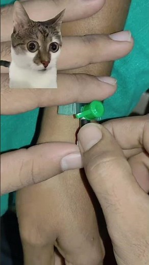 IV Cannulation Techniques Step by Step | Peripheral IV Cannula Insertion | Nursing Skills #shorts