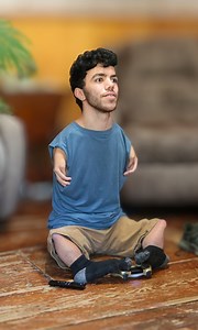 My rare limb difference made me go viral 🌟 | Born Different