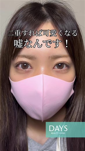 二重にすれば可愛いは嘘です！#二重整形 #二重埋没 #アイプチ 施術名：埋没二重術 施術の説明：医療糸を使用して二重を作る施術 施術の副作用（リスク）：頭痛・痒み・目がゴロゴロする、左右差があると感じる、違和感を感じるなどを生じることがある 施術の価格：98,000円〜448,800円 施術名：目頭切開 施術の説明：目頭を切ることで蒙古襞をなくす施術 施術の副作用（リスク）：傷跡、左右差、違和感、感染など 施術の価格：295,000円〜327,800円