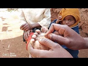 Jigger digging Lucy// African village life #Kenya