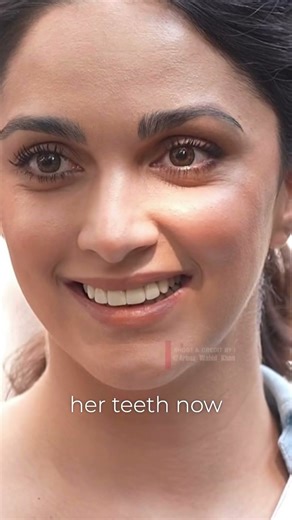 Have you noticed Kiara Advani's teeth?