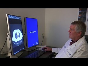 Lung cancer survival rate increasing