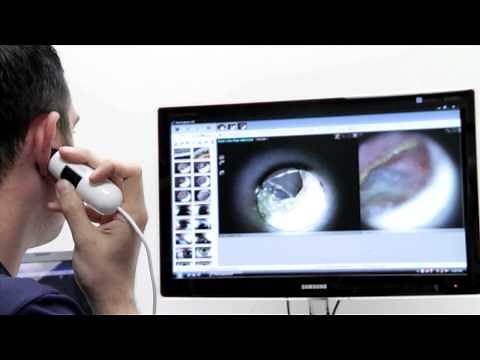 Dino-Lite AM311H / AM3111H Handheld Digital Earscope