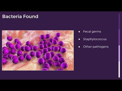 🤯 Your Cell Phone is 10x Dirtier than a Toilet Seat! (The Gross Friend)