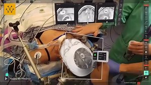 Another use case of the Medivis' SurgicalAR being used in the operating room. Video Credit: Medivis #technology #medivis #engineering #augmentedreality #virtualreality #health #healthtech -------------------------------- Want to share your company's tech on Wevolver? Wevolver is a platform used by millions of engineers to stay up to date about the latest technologies. Learn how you can share your company's technology with Wevolver's community and reach a global audience of engineers: https://wev