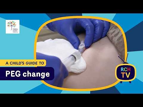 A child's guide to hospital: PEG Change