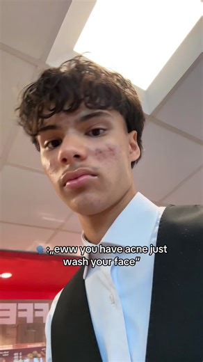 Effective Skincare Routine to Manage Acne